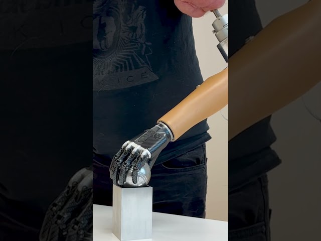 The world's first above-the-elbow bionic arm! #sweden #medtech #innovation #bionics