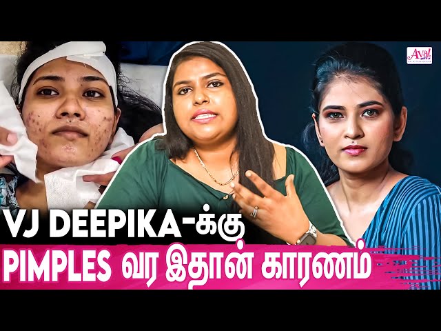 Pimples வந்தா இத மட்டும் பண்ணுங்க : Dr Asha Queen About Vj Deepika's Pimples Treatment