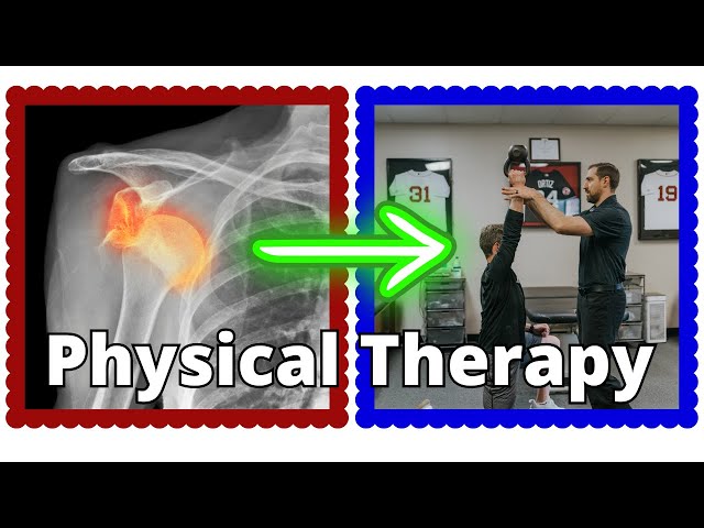 6 Keys to Shoulder Instability Physical Therapy
