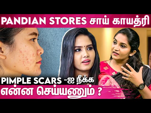 Pimples ஐ கவனிக்கலனா cancer ஆக மாறுமா ? Dr.S. Krithika Ravindran Interview About Skincare Treatment