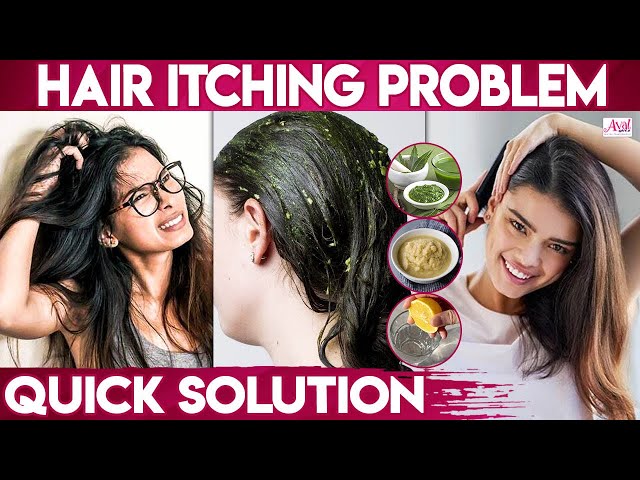 Itchy Scalp Treatments | Remedies For Dandruff, Lice and Scalp Acne