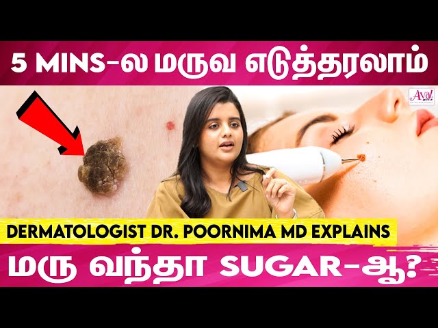 மருவ கவனிக்கலான சீக்கிரமா பரவும்! - Dermatologist Dr.Poornima MD Explains | Warts | Skin Tags