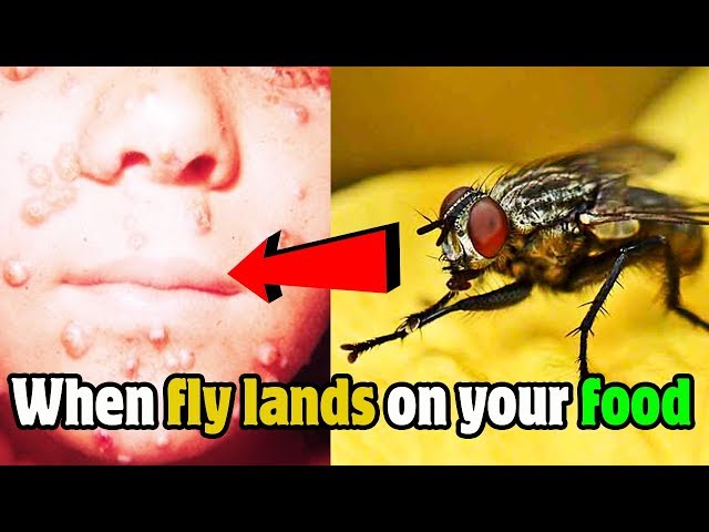 What Happens When A Fly Lands On Your Food?