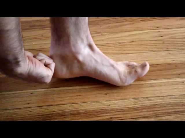 short foot posture explanation
