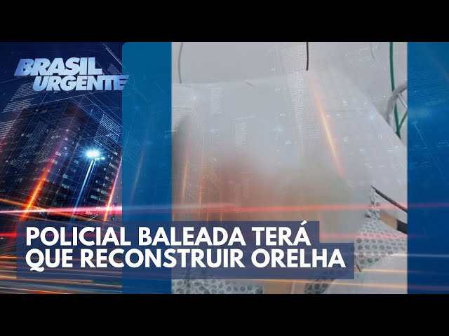 Policial baleada terá que reconstruir orelha | Brasil Urgente