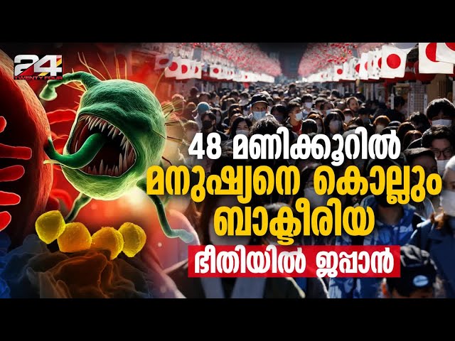 "മാംസം ഭക്ഷിക്കുന്ന" ബാക്ടീരിയ ജപ്പാനെ വലിഞ്ഞ് മുറുക്കുന്നു;ജപ്പാനിൽ പടർന്ന് പുതിയ രോഗം