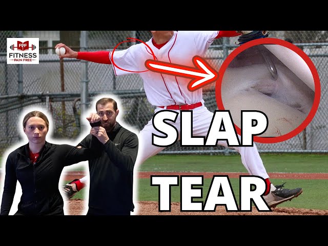 SLAP Tear Clinical Examination [Physical Therapist Guide]