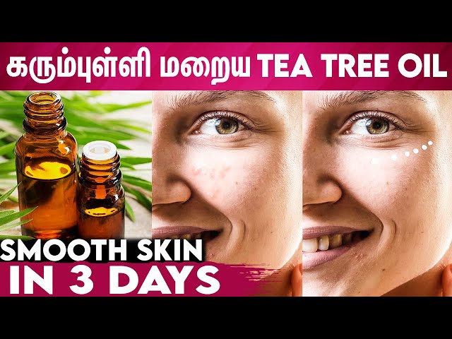Beauty Benefits Of Tea Tree Oil | Reduce Wrinkles, Skin Pigmentation, Dark Spots, Beauty Tips