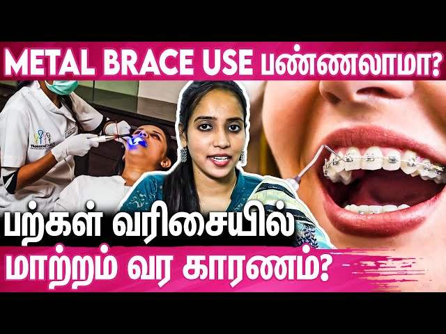 Teeth Brace போடுறதுக்கு முன் இத கண்டிப்பா பாருங்க : Dr.Sheik Arifa, Dentist | Metal Teeth Brace