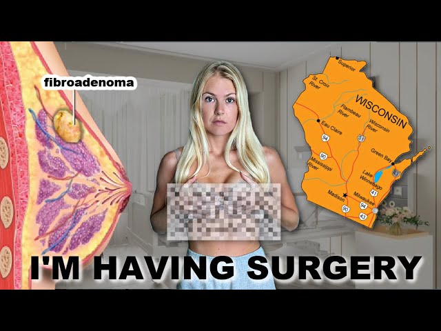 I'M HAVING SURGERY + Wisconsin Vlog