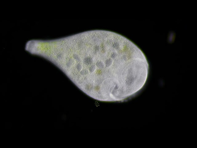 Single-celled organism Stentor polymorphus in darkfield