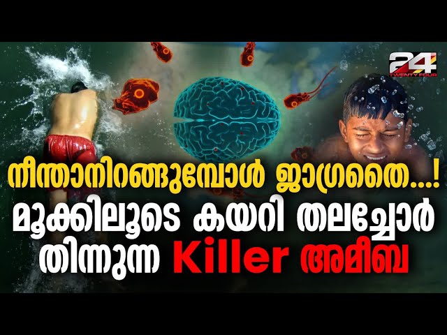 ജലാശയത്തിൽ ഇറങ്ങുമ്പോൾ മൂക്കിലൂടെ ശരീരത്തിൽ എത്തി രോഗി കോമയിലായി മരിക്കുന്നു Brain-Eating Amoeba