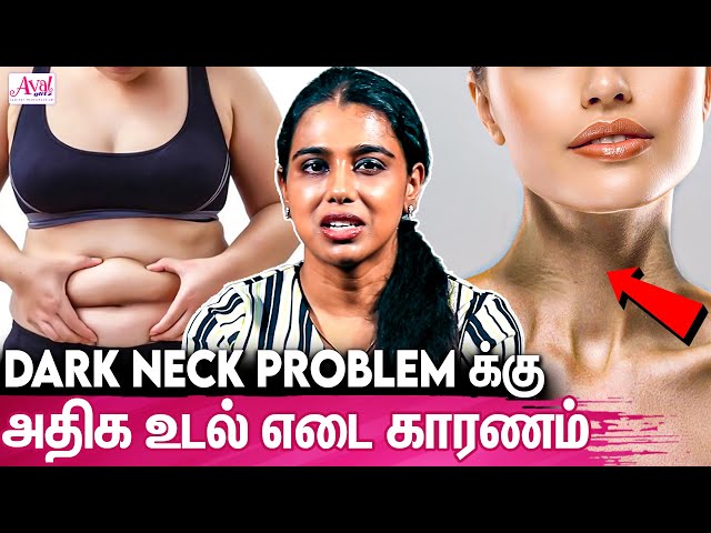 Dark neck ஐ சரிசெய்ய எளிய வழிகள் : Dr Trishna Vaishali About Neck Pigmentation | Simple Tips