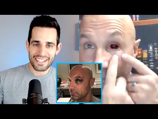 Christopher Daniels' Eye Is Still REALLY Messed Up