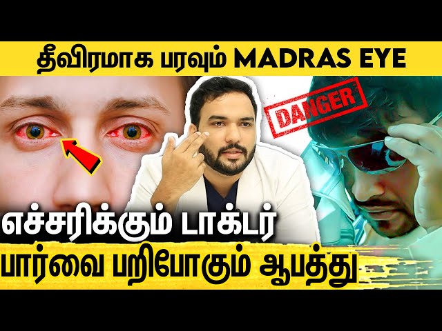 Madras Eye வராமல் தடுக்க இதுதான் வழி : Eye Specialist Dr.Syed Moosa Interview About Madras Eye