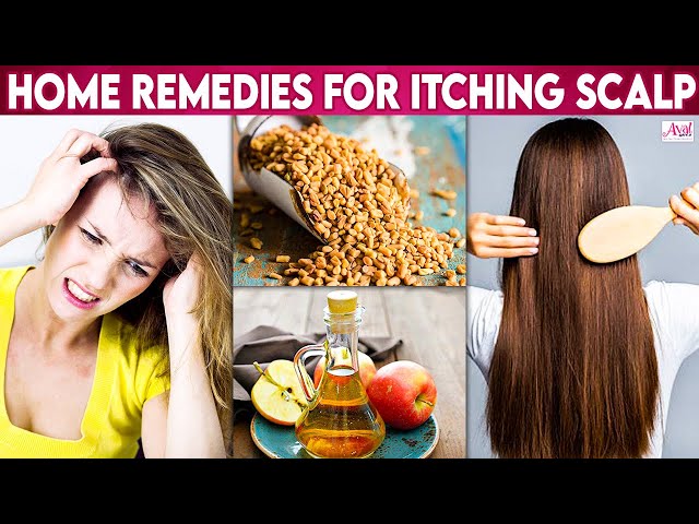 தலையில் அரிப்பா? குணப்படுத்த Quick tips | Healthy Hair, Treatment, Home Remedy