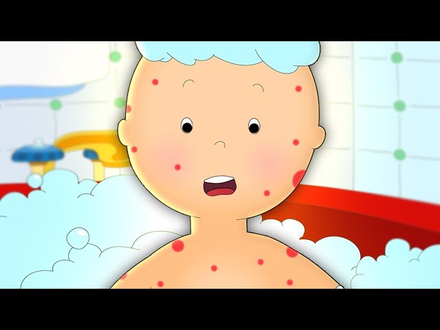 Caillou and the Rash ★ Funny Animated Caillou | Cartoons for kids | Caillou