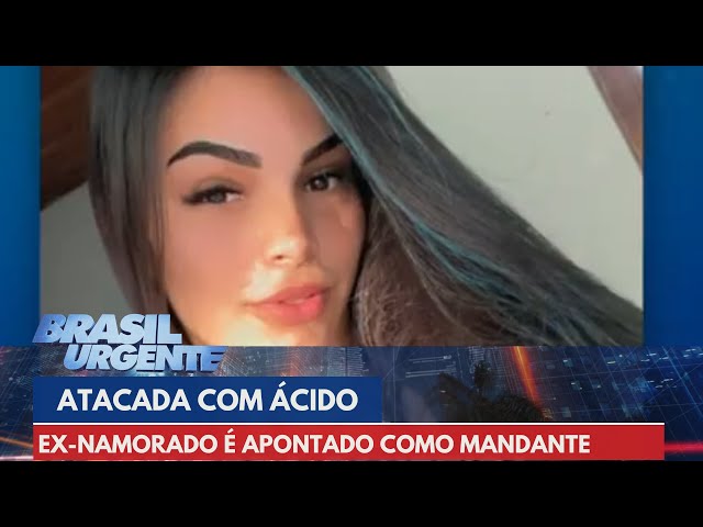 Ex-namorado da moça atacada com soda cáustica é apontado como mandante | Brasil Urgente