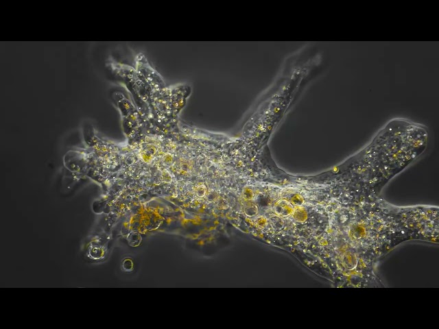 Amoeba in phase contrast