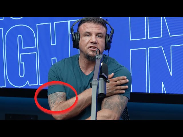 What Happened To Frank Mir’s Right Arm?