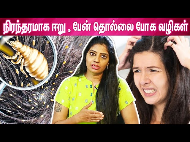 ஈறு பேன் தொல்லைக்கு இயற்கையான தீர்வு - Vinoth Bhama | Hair Care Home Remedies , Remove Lice Tips