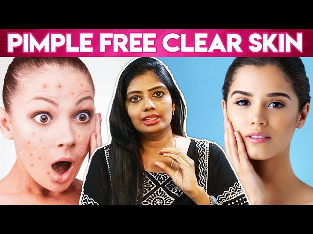 How To Remove Pimples Overnight | Acne Treatment, Home Remedies | Vinoth Bhama