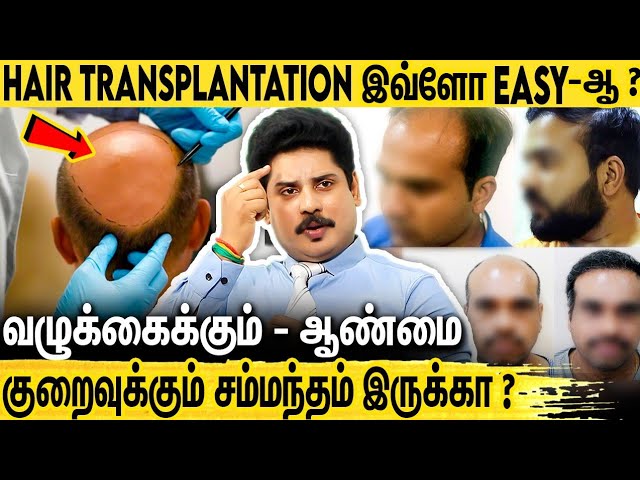 Hair Transplant இவ்ளோ Easy-ஆ ? : Dr.Rams Trichology and Aesthetics Interview About Hair Transplant
